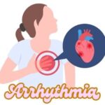 Arrhythmia