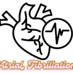 Atrial Fibrillation