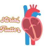 Atrial Flutter