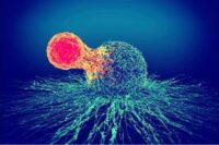 T-cell cancer