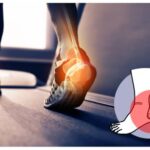 heel pain