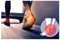 heel pain